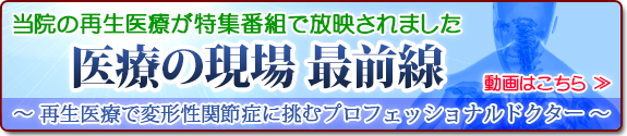 医療の現場 最前線 ~再生医療で変形性関節症に挑むプロフェッショナルドクター~